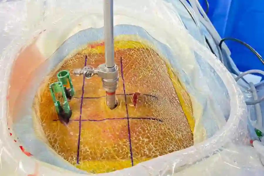 Endo Fusion